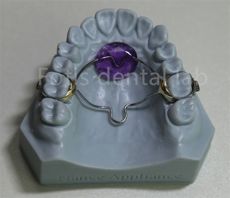 Dental Lab Murah Ortodontik Expander Retainer Efektif Dalam Menjaga Dan Mengembang gigi