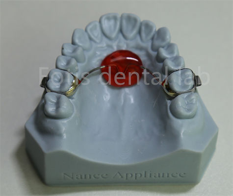 Dental Lab Ortodontik Palatal Expander Terjangkau dan Kompatibel dengan Sebagian Besar Perawatan