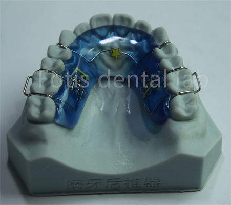 Mudah dibersihkan dan dirawat Versatile Ortodontik Palatal Expander untuk gigi tahan lama