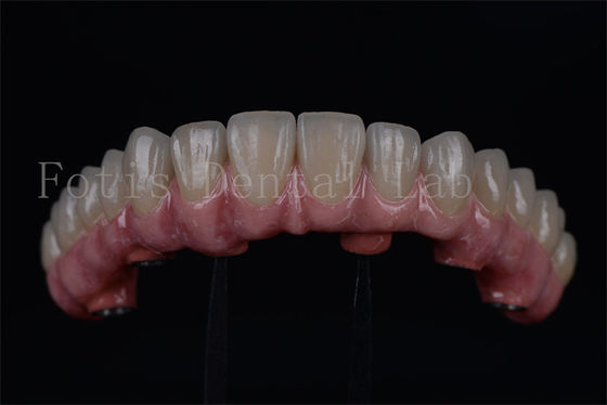 Harga yang bagus Titanium / Zirconia tahan lama semua pada 4 semua pada 6 pemulihan cepat 1-2 minggu on line